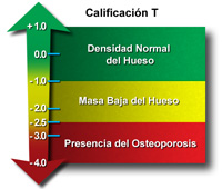 El gráfico muestra T score